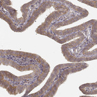 Immunohistochemical staining of human fallopian tube shows moderate cytoplasmic positivity in glandular cells.