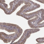 Immunohistochemical staining of human fallopian tube shows moderate cytoplasmic positivity in glandular cells.