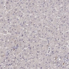 Immunohistochemical staining of human liver shows no positivity in hepatocytes as expected.