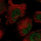 Anti-FAM208B Antibody