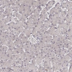 Immunohistochemical staining of human liver shows no positivity in hepatocytes as expected.