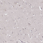 Immunohistochemical staining of human cerebral cortex shows no positivity in neurons as expected.