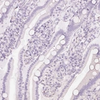 Immunohistochemical staining of human duodenum shows no positivity in glandular cells as expected.
