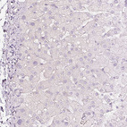 Immunohistochemical staining of human liver shows no positivity in hepatocytes as expected.
