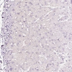 Immunohistochemical staining of human liver shows no positivity in hepatocytes as expected.