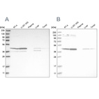 Western blot analysis using Anti-CNP antibody HPA023278 (A) shows similar pattern to independent antibody HPA023266 (B).