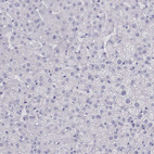 Immunohistochemical staining of human liver shows no positivity in hepatocytes as expected.