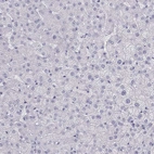 Immunohistochemical staining of human liver shows no positivity in hepatocytes as expected.