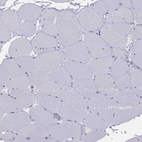 Immunohistochemical staining of human skeletal muscle shows no positivity in myocytes as expected.