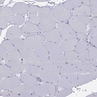 Immunohistochemical staining of human skeletal muscle shows no positivity in myocytes as expected.