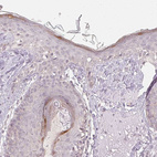 Immunohistochemical staining of human skin shows moderate cytoplasmic positivity in a subset of keratinocytes.