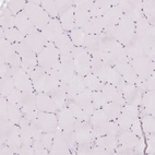 Immunohistochemical staining of human skeletal muscle shows no positivity in myocytes as expected.