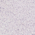 Immunohistochemical staining of human liver shows no positivity in hepatocytes as expected.