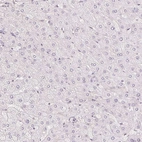 Immunohistochemical staining of human liver shows no positivity in hepatocytes as expected.