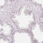 Immunohistochemical staining of human prostate shows no positivity in glandular cells as expected.