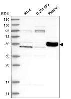Western blot analysis in human cell line RT-4, human cell line U-251 MG and human plasma.