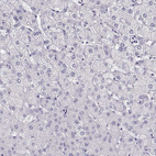 Immunohistochemical staining of human liver shows no cytoplasmic positivity in hepatocytes as expected.