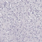 Immunohistochemical staining of human liver shows no cytoplasmic positivity in hepatocytes as expected.