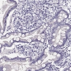Immunohistochemical staining of human small intestine shows no cytoplasmic positivity in glandular cells as expected.
