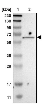 Lane 1: Marker [kDa] 230, 130, 95, 72, 56, 36, 28, 17, 11_br/_Lane 2: Human cell line RT-4
