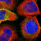Immunofluorescent staining of human cell line A-431 shows localization to nucleoplasm, plasma membrane & cytosol.