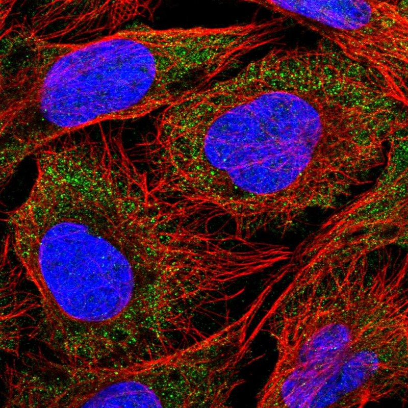 Anti-SLC18B1 Antibody
