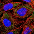 Anti-SLC18B1 Antibody