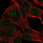 Immunofluorescent staining of human cell line SH-SY5Y shows localization to nucleus.