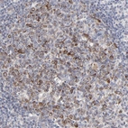 Immunohistochemical staining of human lymph node shows strong cytoplasmic positivity in germinal center cells.