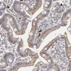 Immunohistochemical staining of human duodenum shows moderate cytoplasmic positivity in glandular cells.