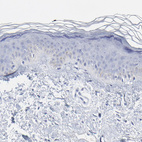 Immunohistochemical staining of human skin shows no positivity in squamous epithelial cells as expected.