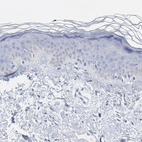 Immunohistochemical staining of human skin shows no positivity in squamous epithelial cells as expected.