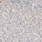 Immunohistochemical staining of human liver shows no positivity in hepatocytes as expected.
