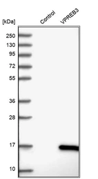 Western blot analysis in control (vector only transfected HEK293T lysate) and VPREB3 over-expression lysate (Co-expressed with a C-terminal myc-DDK tag (~3.1 kDa) in mammalian HEK293T cells, LY415623).
