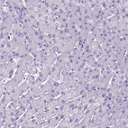 Immunohistochemical staining of human liver shows no positivity in hepatocytes as expected.