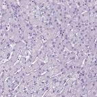 Immunohistochemical staining of human liver shows no positivity in hepatocytes as expected.