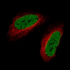 Immunofluorescence staining of U-2 OS cells using the Anti-SATB2 monoclonal antibody, showing specific staining in the nucleoplasm in green. Microtubule- and nuclear probes are visualized in red and blue, respectively (where available).