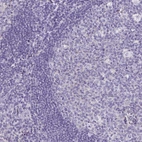 Immunohistochemical staining of human tonsil shows no cytoplasmic positivity in lymphoid cells as expected.
