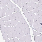 Immunohistochemical staining of human skeletal muscle shows no cytoplasmic positivity in myocytes as expected.