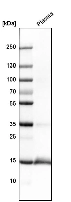 Western blot analysis in human plasma.
