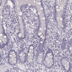 Immunohistochemical staining of human duodenum shows no positivity in glandular cells as expected.