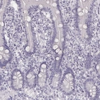Immunohistochemical staining of human duodenum shows no positivity in glandular cells as expected.
