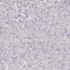 Immunohistochemical staining of human liver shows no positivity in hepatocytes as expected.