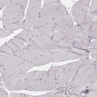 Immunohistochemical staining of human skeletal muscle shows no positivity in myocytes as expected.