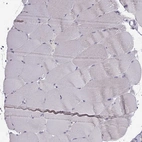 Immunohistochemical staining of human skeletal muscle shows no positivity in myocytes as expected.