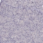 Immunohistochemical staining of human pancreas shows no positivity in exocrine glandular cells as expected.