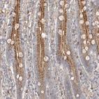 Immunohistochemical staining of human duodenum shows strong cytoplasmic granular and membranous positivity in glandular cells.