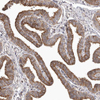 Immunohistochemical staining of human fallopian tube shows strong cytoplasmic and membranous positivity in glandular cells.