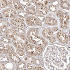 Immunohistochemical staining of human kidney shows moderate cytoplasmic granular positivity in cells in tubules.