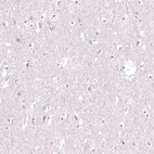Immunohistochemical staining of human cerebral cortex shows no positivity in neurons as expected.